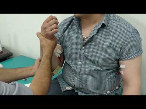 Видео: Інтерференційна ЕМГ