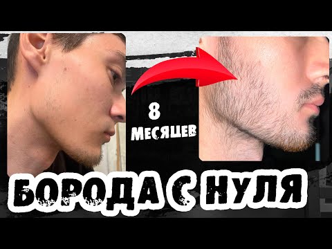 Видео: Капиксил М запустил рост бороды / Результаты / Выпуск 52 / Андрей Борода