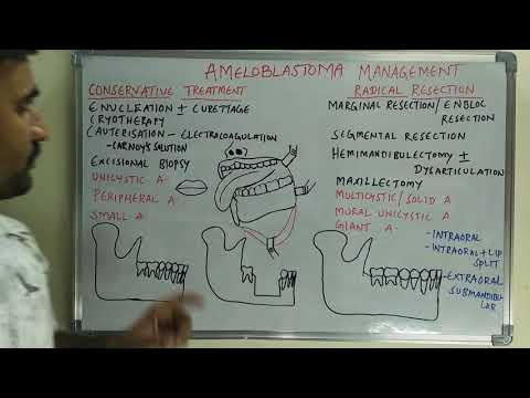 Видео: Лечение амелобластомы