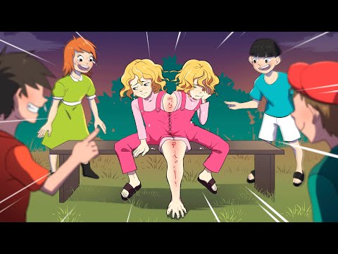 Видео: Каково быть Сиамскими Сёстрами ?