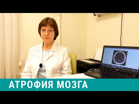 Видео: Атрофия мозга: причины, признаки, лечение
