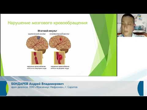 Видео: Артериальная гипертензия диализного пациента
