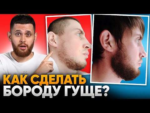 Видео: Были волосы на бороде, но хотелось ГУЩЕ / Результаты средств для бороды