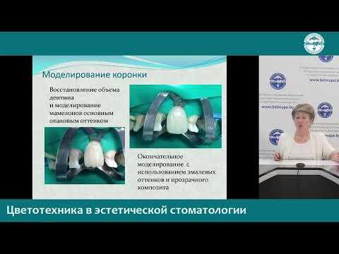 Видео: 3 ноября 2021 г. - «Базисные вопросы восстановительной стоматологии»