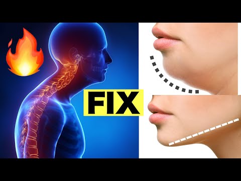 Видео: Как исправить горб на шее и сделать лицо стройным✨