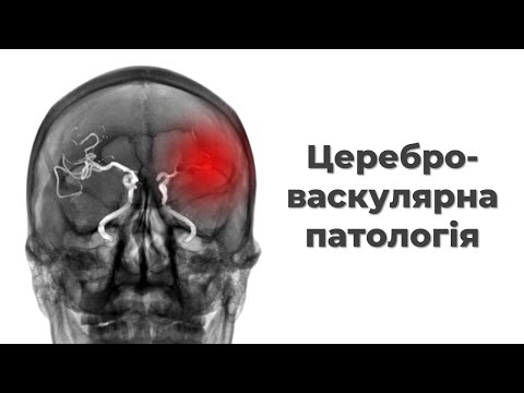 Видео: Цереброваскулярна патологія
