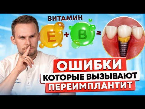 Видео: ЭТИ 5 ошибок РАЗРУШАЮТ ВАШ ИМПЛАНТ! 