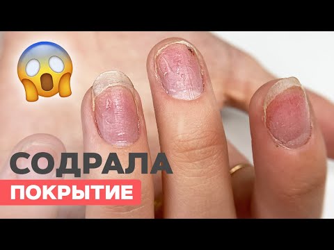 Видео: Что делать? Оторвала гель-лак | Тонкие ногти и наращивание