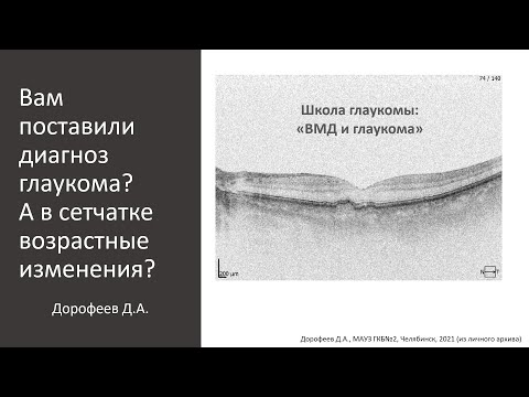 Видео: Школа пациента с глаукомой  09 04 2023