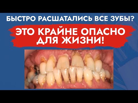 Видео: Генерализованный пародонтит и здоровье человека!