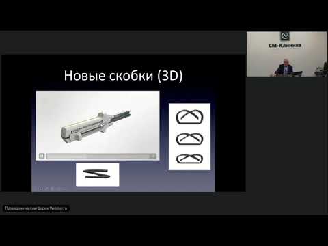 Видео: Волшебный мир сшивающих аппаратов