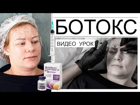 Видео: Ботокс видео урок - подсчет единиц, определение зон введения препарата.