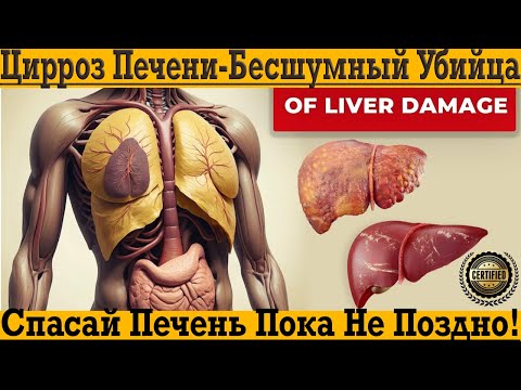 Видео: Спасай ПЕЧЕНЬ пока НЕ ПОЗДНО!