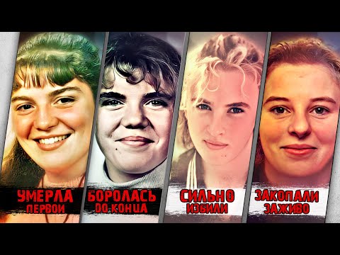 Видео: Сиамские братья УЖАСА. Дело братьев Журден