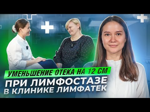 Видео: Уменьшение отека ног на 12 см при лимфостазе в Клинике Лимфатек.