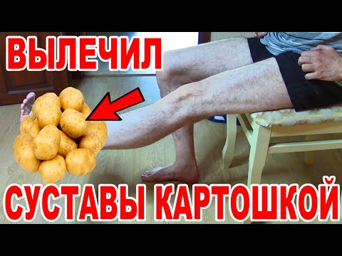 Видео: Вылечил Суставы Картошкой и Комплексом Упражнений. Гимнастика для лечения Спины и Всех суставов