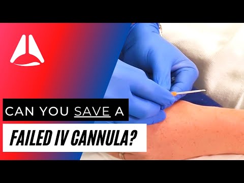 Видео: Можно ли безопасно спасти сломанную внутривенную канюлю?