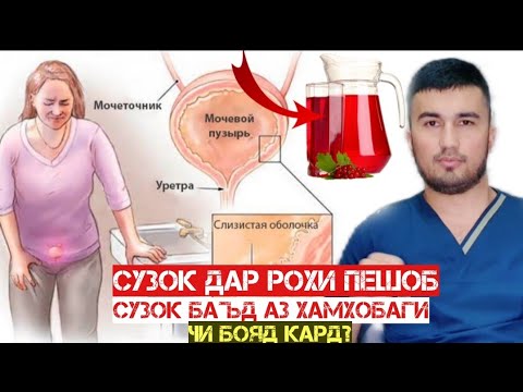 Видео: Сузок баъд аз хамхобаги, сузок дар вакти пешоб кардан. Чи бояд кард?01.04 2023 г.