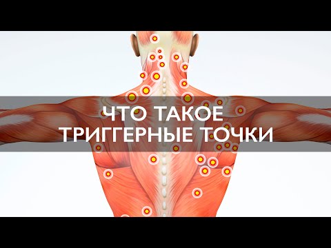 Видео: Триггерные точки | Семинар Адриано Ди Джиакомо | Сухие иглы