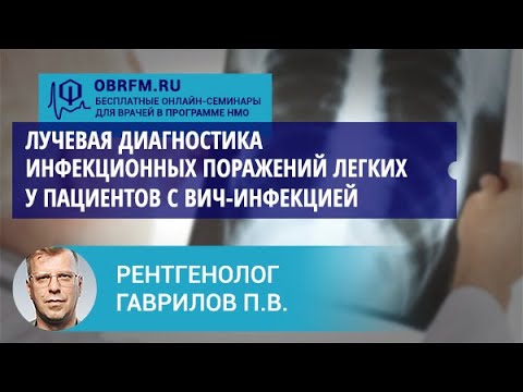 Видео: Рентгенолог Гаврилов П.В.: Лучевая диагностика инфекционных поражений легких у пациентов с ВИЧ