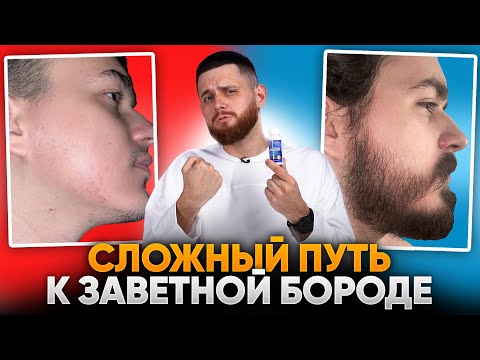 Видео: Прошел через сложности и отрастил бороду викинга! Результаты ксиноксина для роста бороды