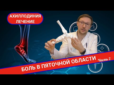 Видео: КАК ЛЕЧИТСЯ АХИЛЛОВО СУХОЖИЛИЕ. Ахиллодиния (Часть 2)