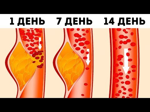 Видео: Что Такое Диета DASH и Почему Врачи Считают Ее Одной из Лучших