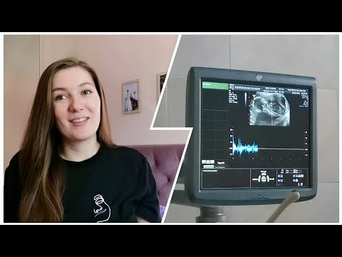 Видео: ДНЕВНИК БЕРЕМЕННОСТИ /14-16 НЕДЕЛИ/ПЛАТНОЕ УЗИ/УЗНАЛИ ПОЛ?