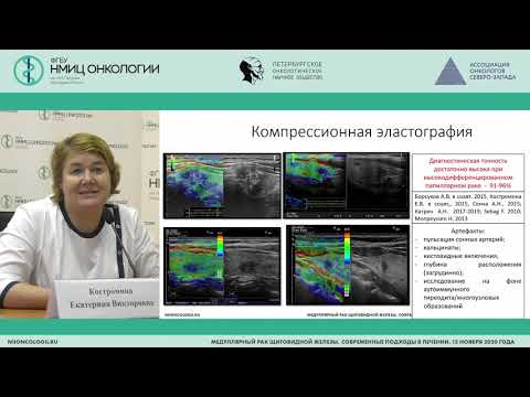 Видео: Ультразвуковая диагностика рака щитовидной железы (Костромина Е.В.)