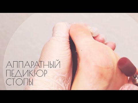 Видео: Аппаратный педикюр стопы