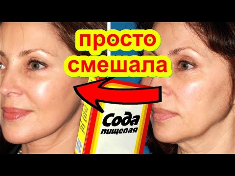 Видео: ПРОСТАЯ СОДА и ЧАЙ ПОДТЯНЕТ Лицо Даже в 70 лет! Маска для лица от морщин Омоложение Лица