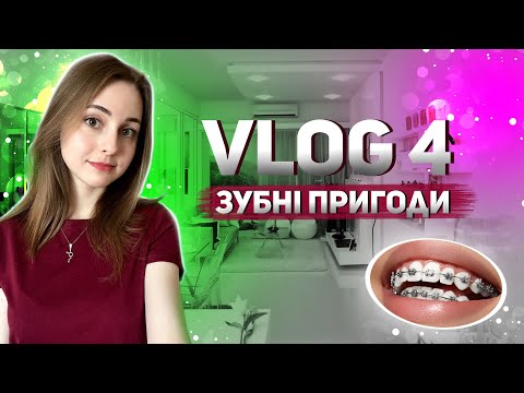 Видео: VLOG 4 - ВСТАНОВЛЕННЯ БРЕКЕТІВ, ПЕРШИЙ ДОСВІД, ПРОГУЛЯНКА