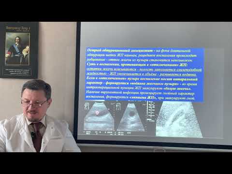 Видео: Острый холецистит как хирургическая проблема.