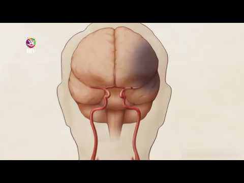 Видео: Тархины судсан дотуурх мэс засал 1