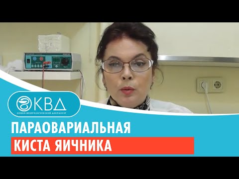 Видео: 👩 1487  Параовариальная киста яичника