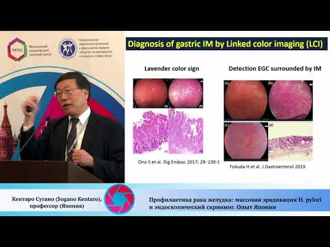Видео: Профилактика рака желудка: массовая эрадикация H. pylori и эндоскопический скрининг. Опыт Японии