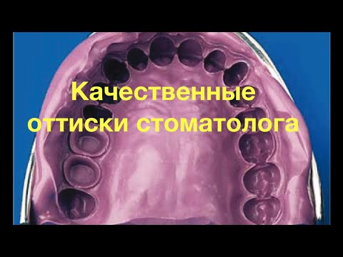 Видео: ОТТИСКИ. ЧАСТЫЕ ОШИБКИ СТОМАТОЛОГА ОРТОПЕДА В СЛЕПКАХ. ВАЖНО КАК ДЛЯ ДОКТОРА ТАК И ДЛЯ ТЕХНИКА.