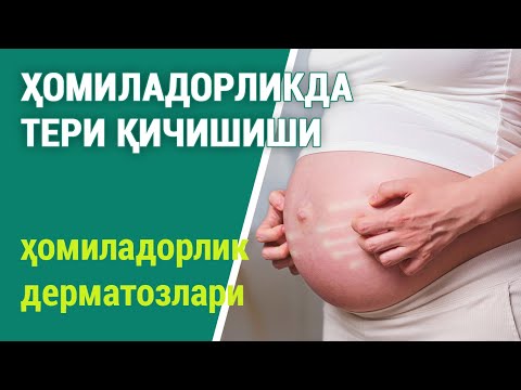 Видео: Ҳомиладорликда тери қичишиши. Ҳомиладорлик дерматозлари.