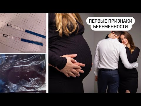 Видео: ПЕРВЫЕ ПРИЗНАКИ БЕРЕМЕННОСТИ ДО ЗАДЕРЖКИ 🤰| КАК Я УЗНАЛА О БЕРЕМЕННОСТИ И КАК РАССКАЗАЛА МУЖУ