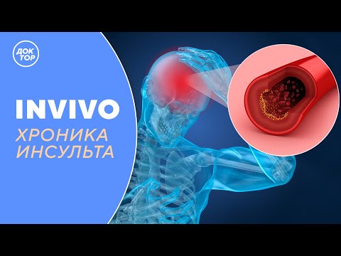 Видео: ХРОНИКА ИНСУЛЬТА | IN VIVO