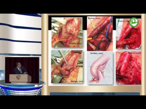 Видео: Котов С В - Хирургия первичных стриктур