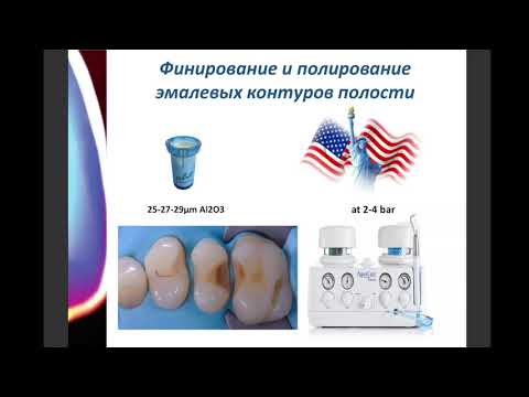 Видео: Типичные ошибки прямой композитной реставрации. Мендоса Е. Ю. Кафедра клинической стоматологии МГМСУ