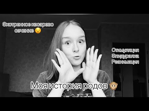 Видео: МОЯ ИСТОРИЯ РОДОВ/ стимуляция, экстренное кесарево, партнерские роды с мужем