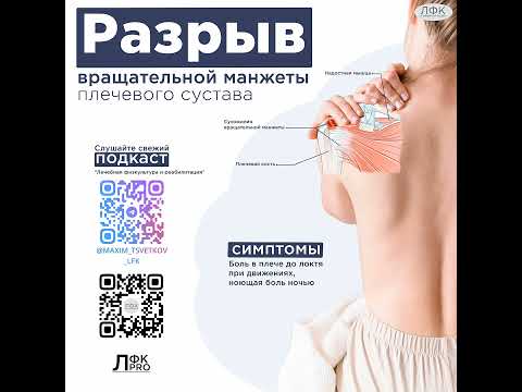Видео: Разрыв вращательной манжеты плечевого сустава