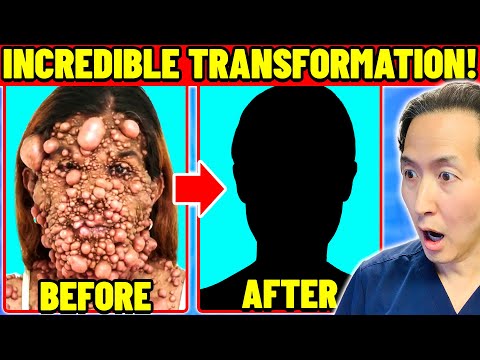 Видео: Вы ОБЯЗАТЕЛЬНО должны увидеть, как она выглядит сейчас! Пластический хирург отреагировал на тяжёл...