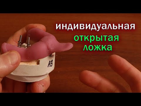 Видео: Индивидуальная открытая ложка, снятия слепков с имплантов, шинирование трансферов поверх ложки