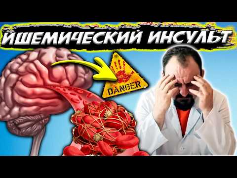 Видео: САМОЕ ГЛАВНОЕ Ишемический инсульт. Как СПАСТИ СОСУДЫ Головного Мозга?