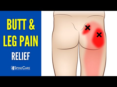 Видео: Как устранить боль в ягодицах и ногах за считанные секунды