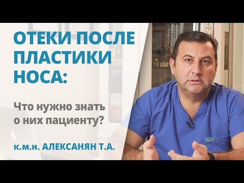 Видео: Отеки после ринопластики: сколько держатся, когда проходят и как ускорить рассасывание
