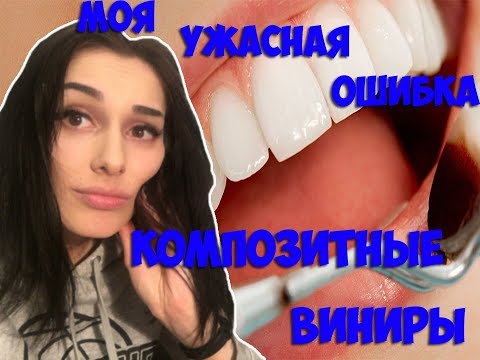 Видео: КОМПОЗИТНЫЕ ВИНИРЫ | МОЯ УЖАСНАЯ ИСТОРИЯ ! МОЖНО ЛИ СНЯТЬ КОМПОЗИТНЫЕ ВИНИРЫ ?